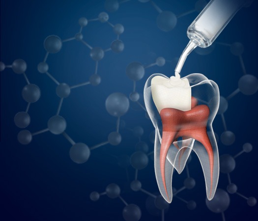 Biodentine XP Brochure